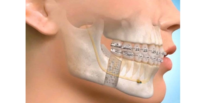 Oral & Maxillofacial Surgeons